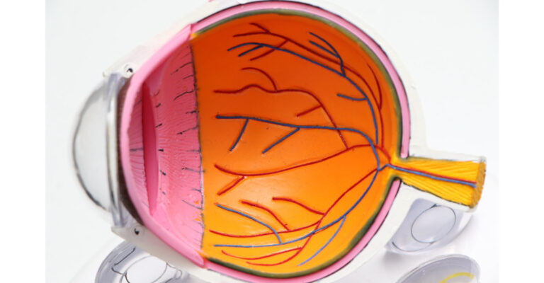 AI can predict heart disease and death based on retina arteries