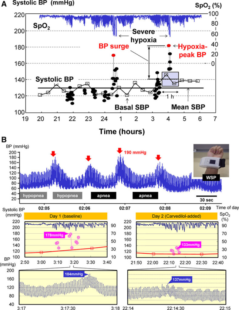 blood pressure at night: check out the graphs